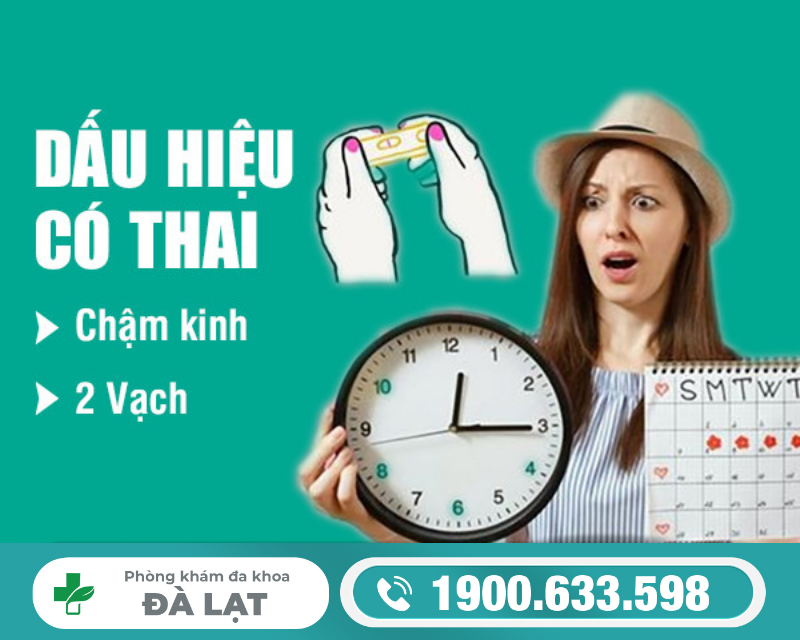 Hình ảnh minh họa